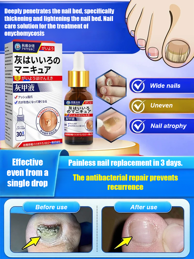 Antifungal nail solution