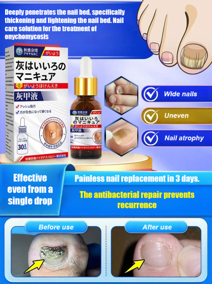 Antifungal nail solution