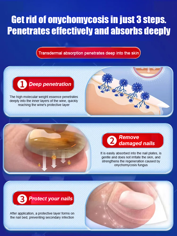 Antifungal nail solution