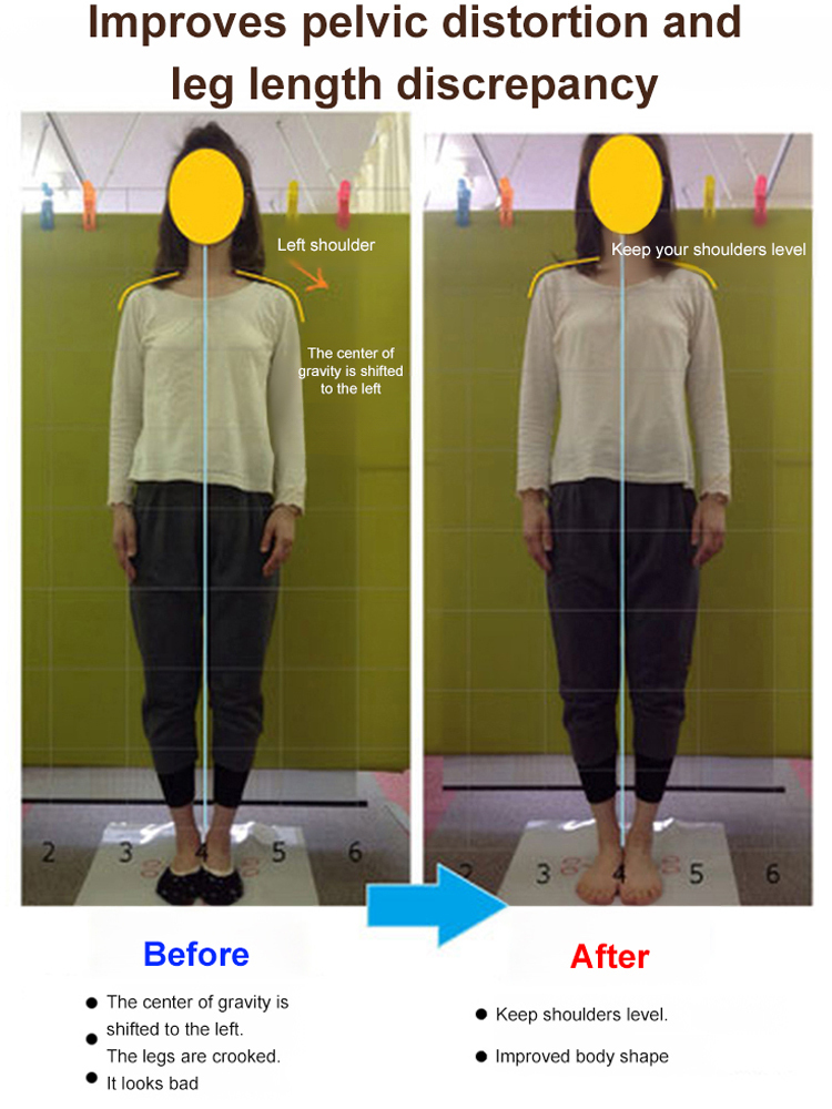 🩴Orthopedic Leather Sandals: Japanese Handmade Arch Support for Plantar Fasciitis & Flat Feet Relief