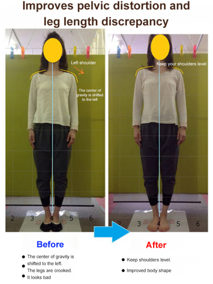 🩴Orthopedic Leather Sandals: Japanese Handmade Arch Support for Plantar Fasciitis & Flat Feet Relief