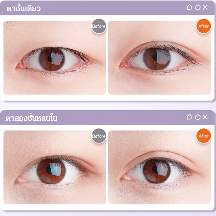 👁️‍🗨️ สร้างตาสองชั้นแบบธรรมชาติได้ในเวลาเพียงไม่กี่วินาที! เทปใสแบบลูกไม้เหล่านี้ระบายอากาศได้ดีเยี่ยม ทำให้คุณดูเหมือนเกิดมาพร้อมกับตาสองชั้น 💫