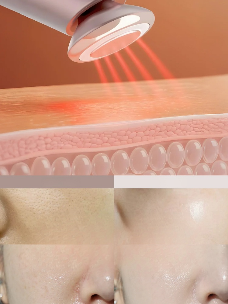 เครื่องยกกระชับผิวหน้าเสริมสวย 