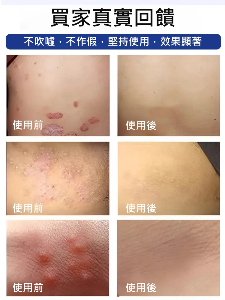 【1粒速止癢】雙黃當歸梔子片