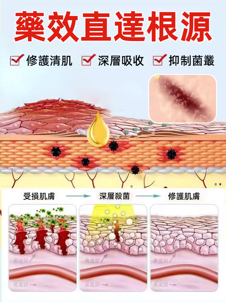 【1粒速止癢】雙黃當歸梔子片