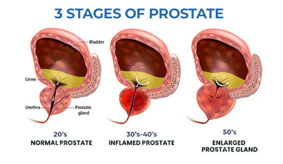LOVILDS™ BeeBoom Nasal Inhaler For Prostate Wellness
