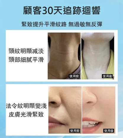 全方位提拉緊致導入儀