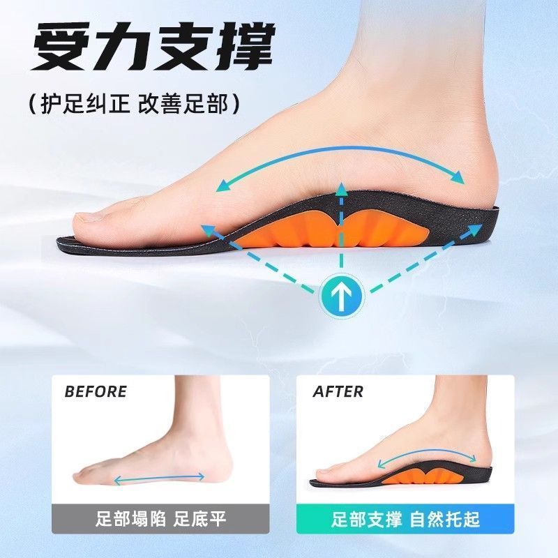 Whale Arch Support Insoles