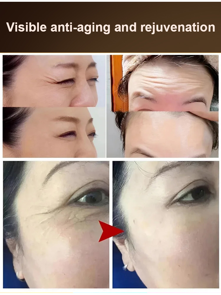 Efficiently nourish the skin, anti-wrinkle, make the skin 10 years younger
