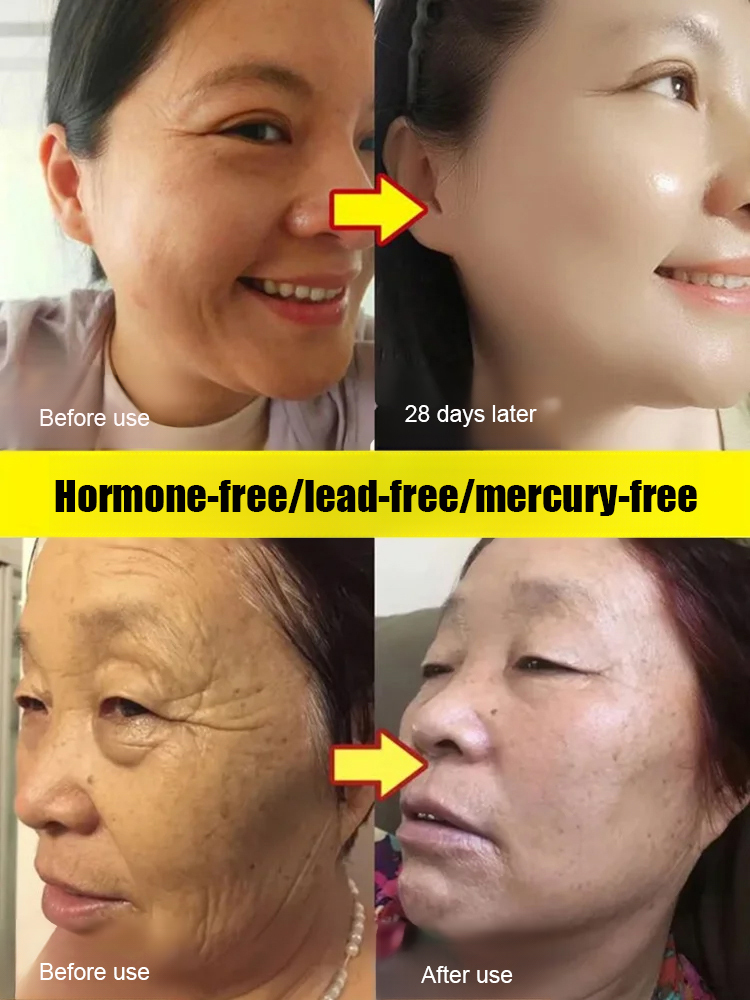 Herbal Anti-Wrinkle Cream