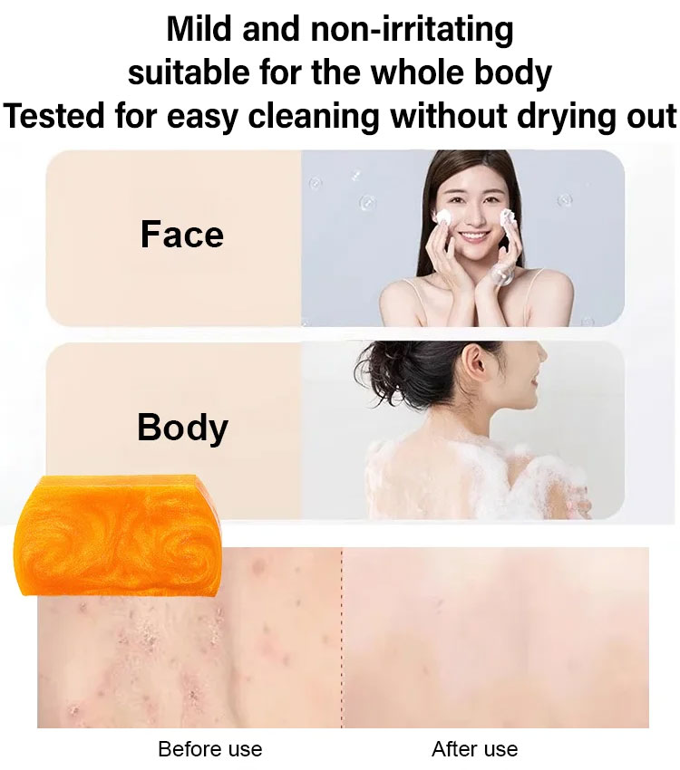 [Anti-Acne, Silky, Nourishing] Luxury Gold Soap