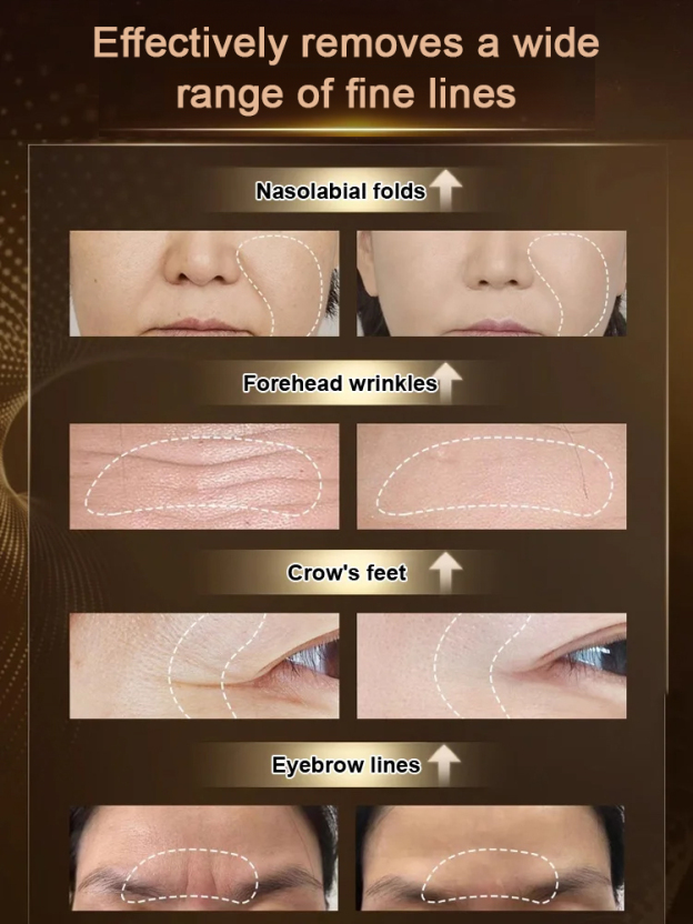 Efficiently nourish the skin, anti-wrinkle, make the skin 10 years younger