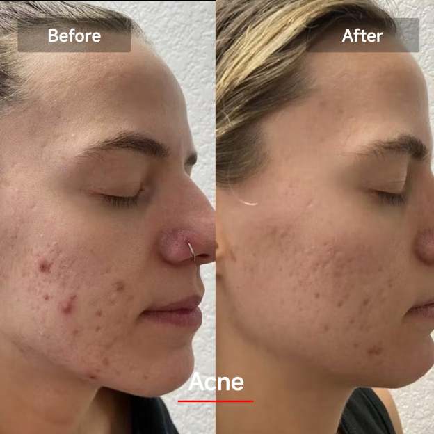 Veonskin LED Face Mask Pro – 7-Color Light Therapy for Skincare