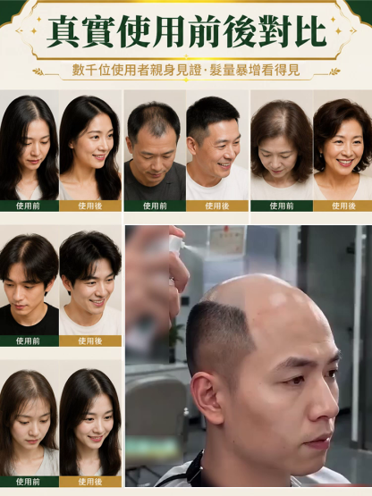 【發量暴增】防脫育發精華液