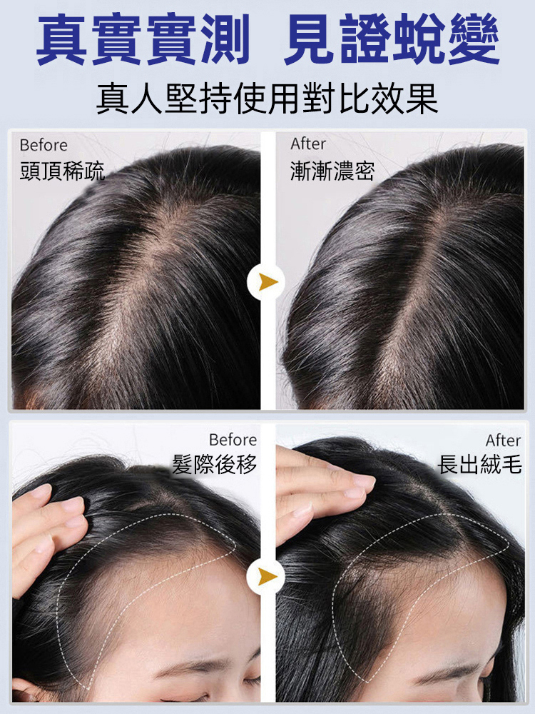 防脫育髪強韌髮根滾珠精華