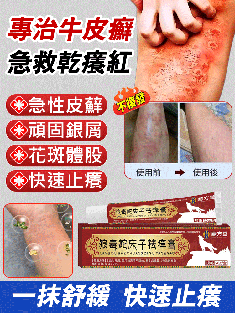 藏方堂狼毒蛇床子祛癢膏