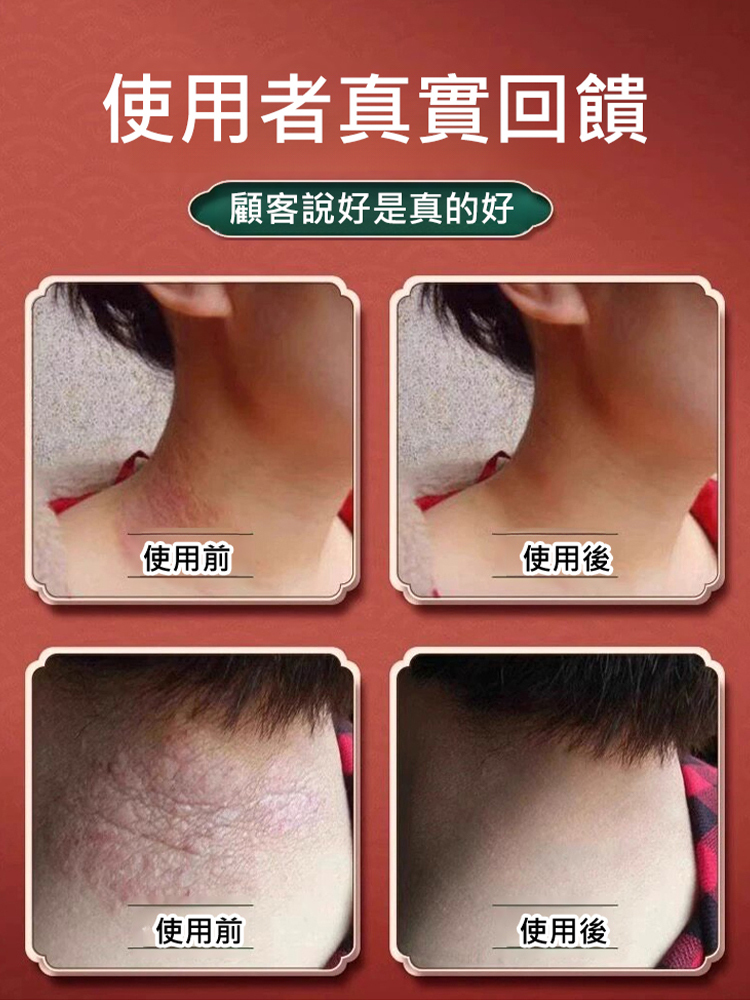 藏方堂狼毒蛇床子祛癢膏