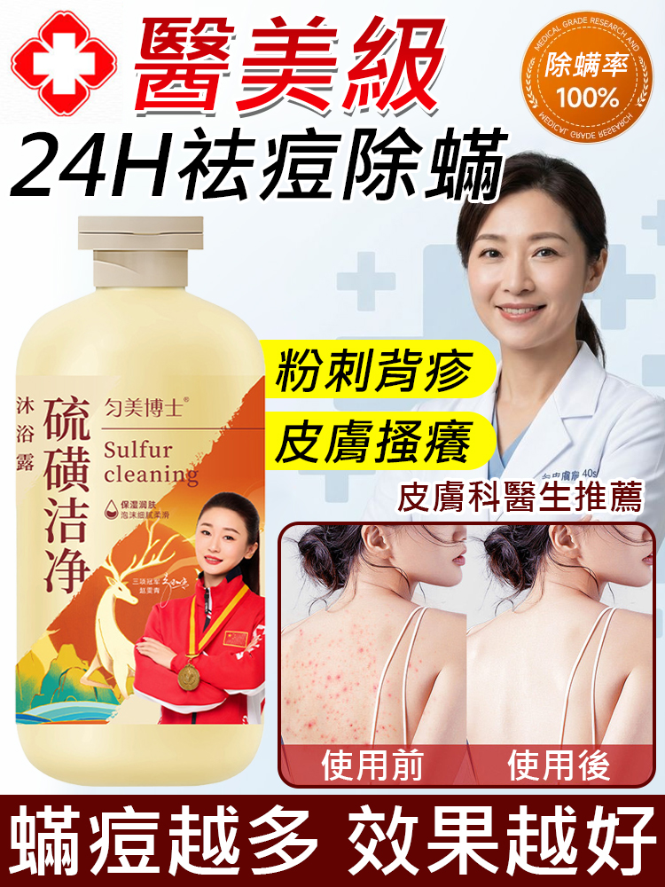 【高效解決背癢頭癢小疙瘩】硫磺除蟎沐浴露