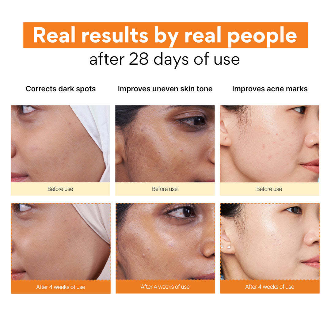 I.N.N.I.S.F.R.E.E Vitamin C Green Tea Enzyme Brightening Serum 7ml