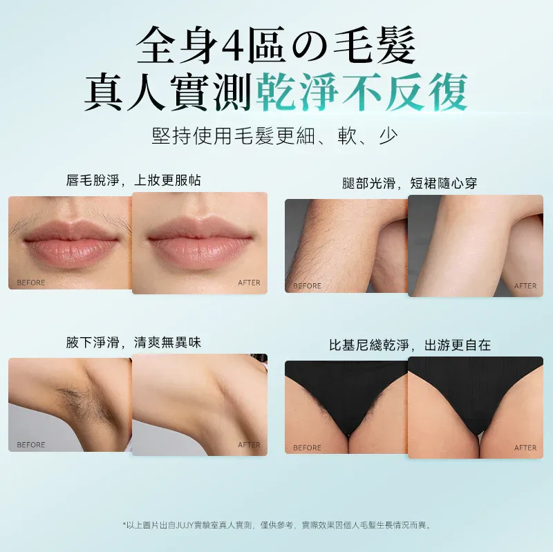 JUJY 雙燈管藍寶石冰點極速連閃無痛嫩膚全身家用脫毛儀 PRO 2.0 [香港行貨]