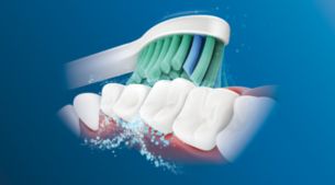 飞利浦 Sonicare 先进的声波技术