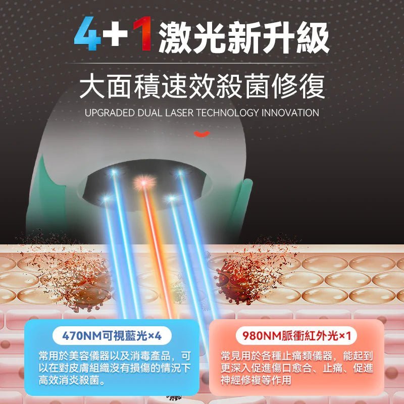 Comforbot 7分鐘深層激光擊退灰甲雙指速效零壓無菌光療機 PRO - DIGIBAL ONLINE3