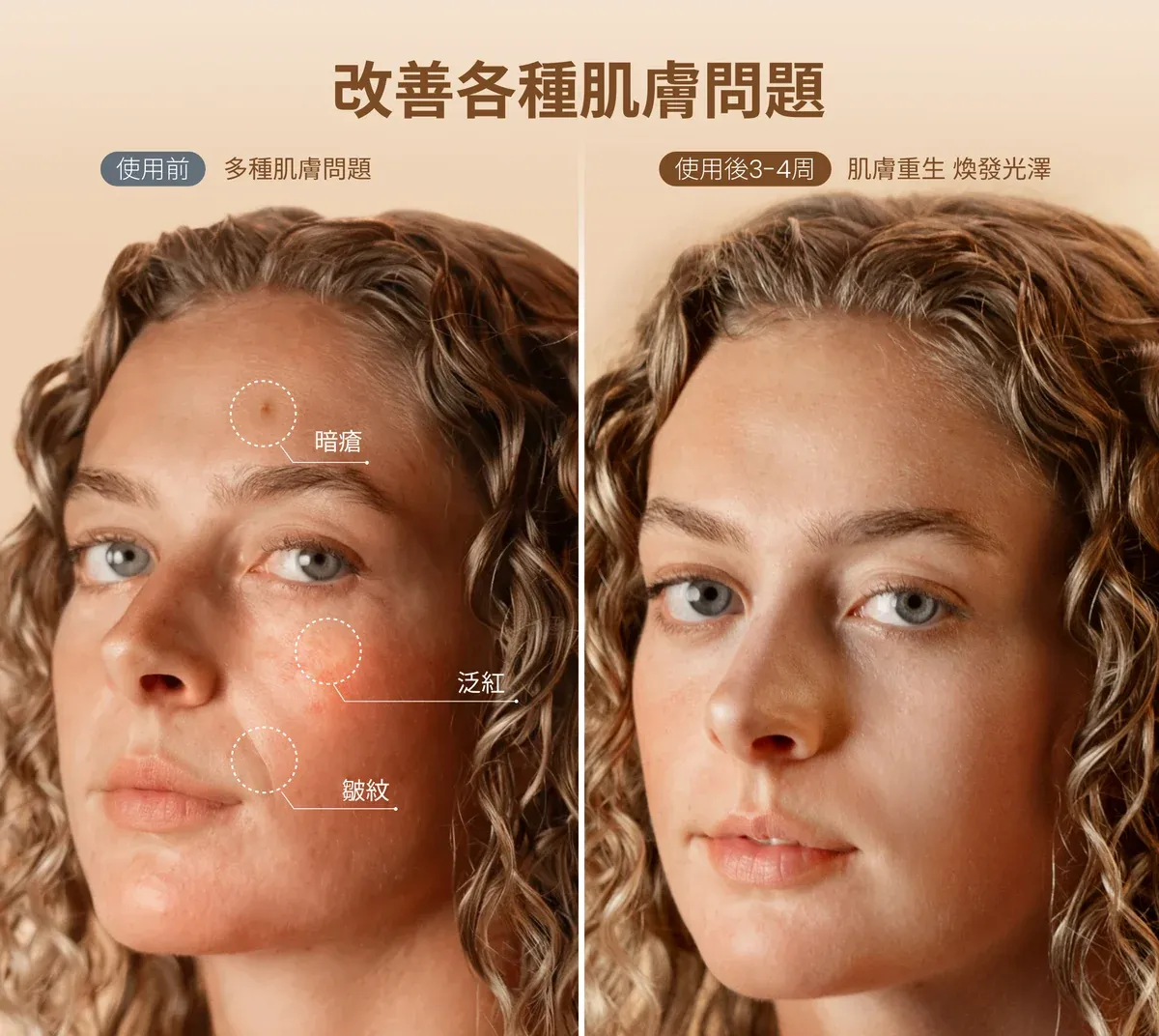 RENPHO REJUVEN Artemis Blush LED 光療柔膚面膜儀（E100B）[香港行貨]