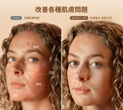 RENPHO REJUVEN Artemis Blush LED 光療柔膚面膜儀（E100B）[香港行貨]
