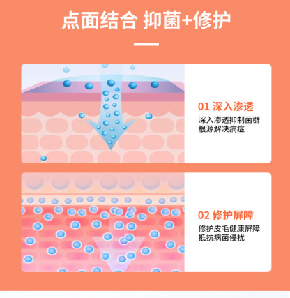 寵物貓癬除蟎噴霧真菌液止癢貓狗皮膚病噴劑狗癬蟎蟲皮炎外用噴霧