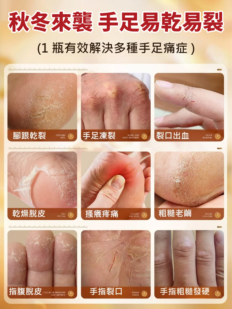 中藥成分止癢潤膚露