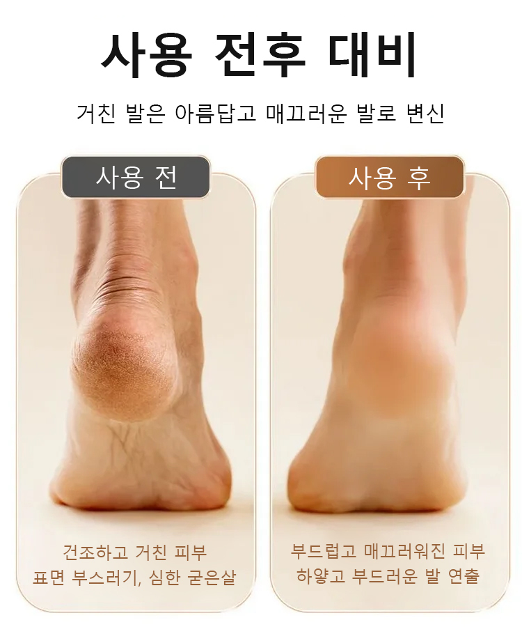 [굳은살 제거] 전동 발각질 제거기