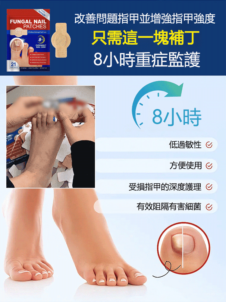 指甲修護矯正抑菌貼