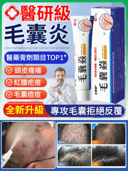 頭皮祛痘止癢毛囊膏