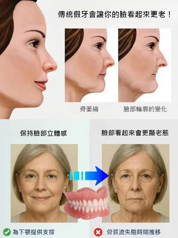 【免看牙醫】美白仿真牙套