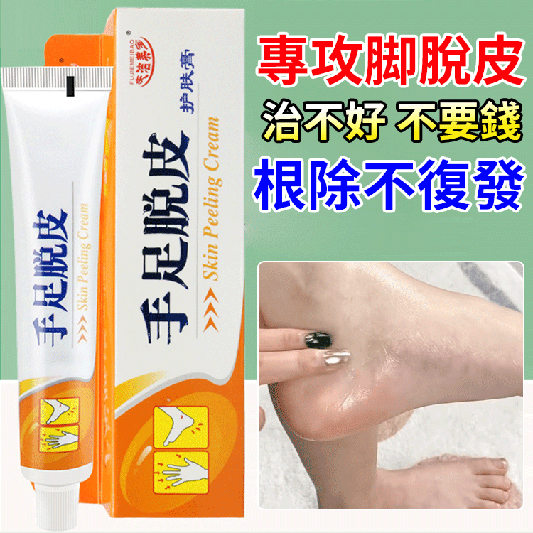 【脫皮專用】手足脫皮抑菌膏