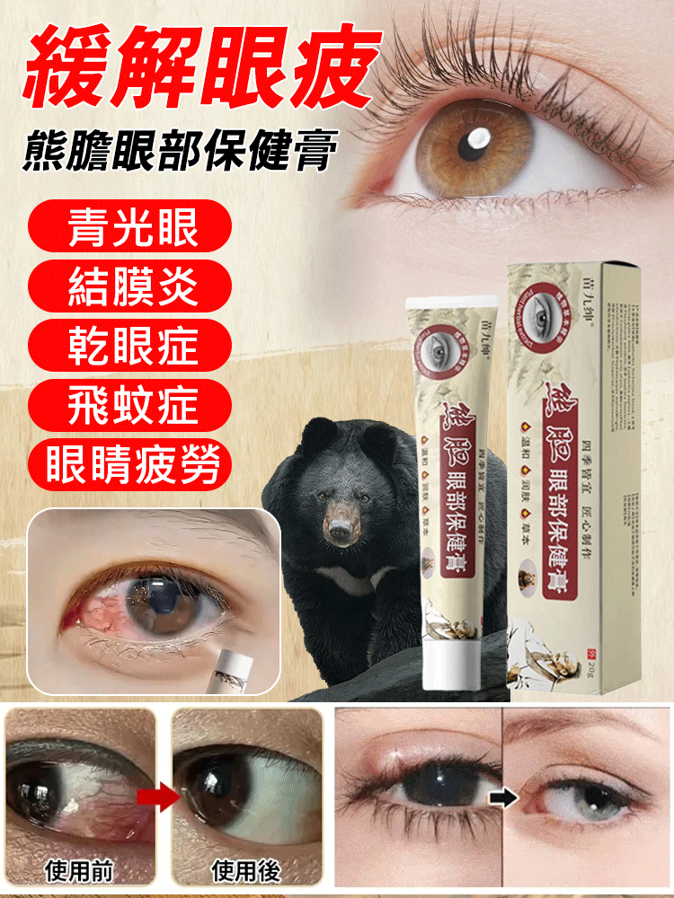 熊膽眼保健膏