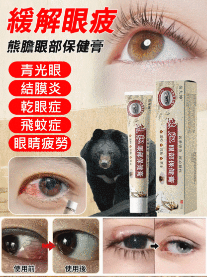 熊膽眼保健膏