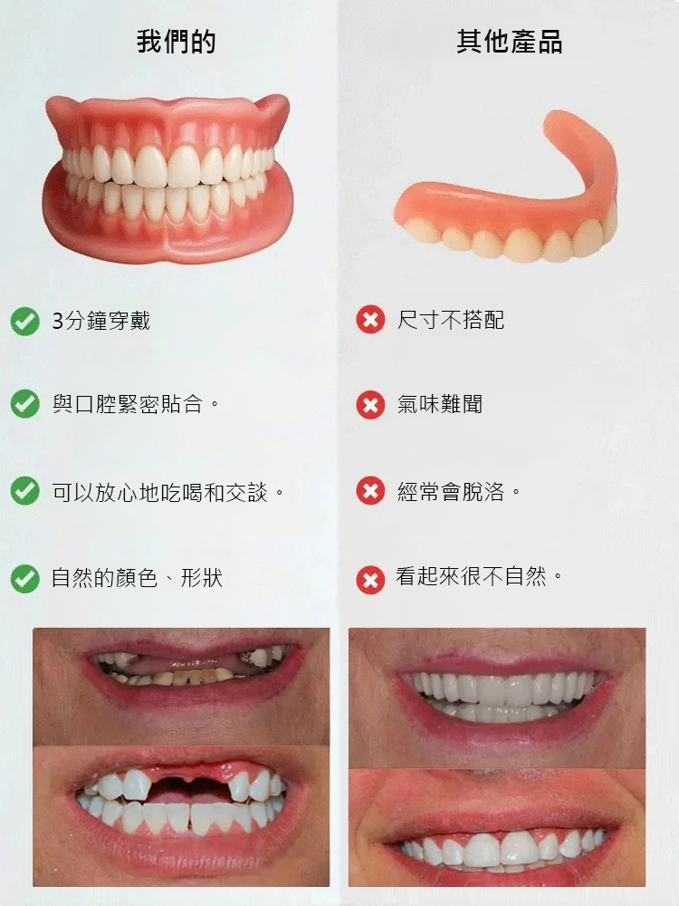 【免看牙醫】美白仿真牙套