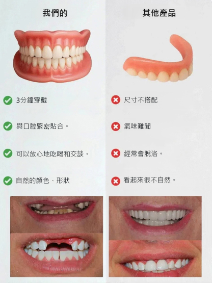 【免看牙醫】美白仿真牙套