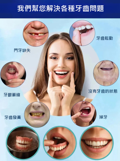 【免看牙醫】美白仿真牙套