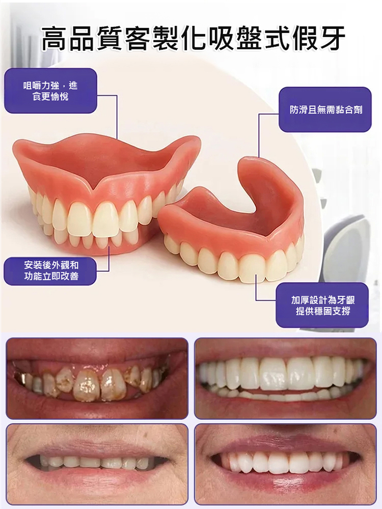【免看牙醫】美白仿真牙套
