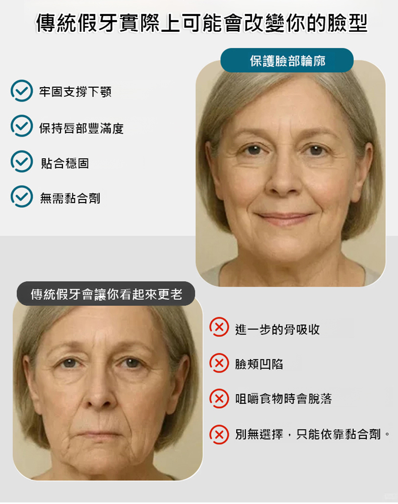 假牙修飾美牙套裝 