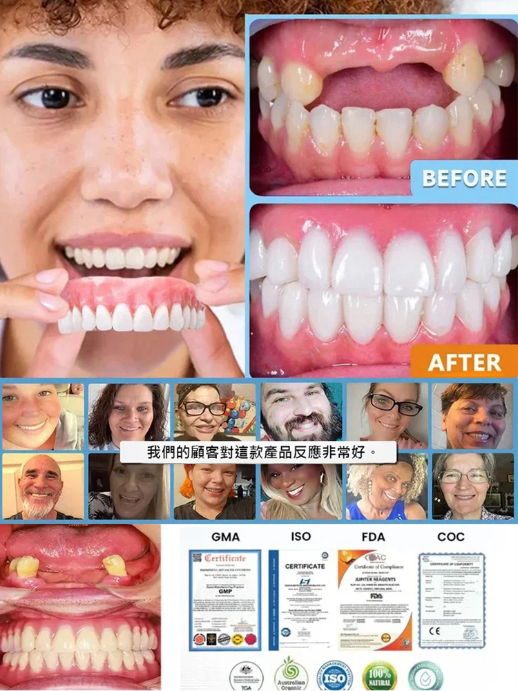 【免看牙醫】美白仿真牙套