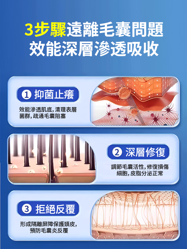 頭皮祛痘止癢毛囊膏