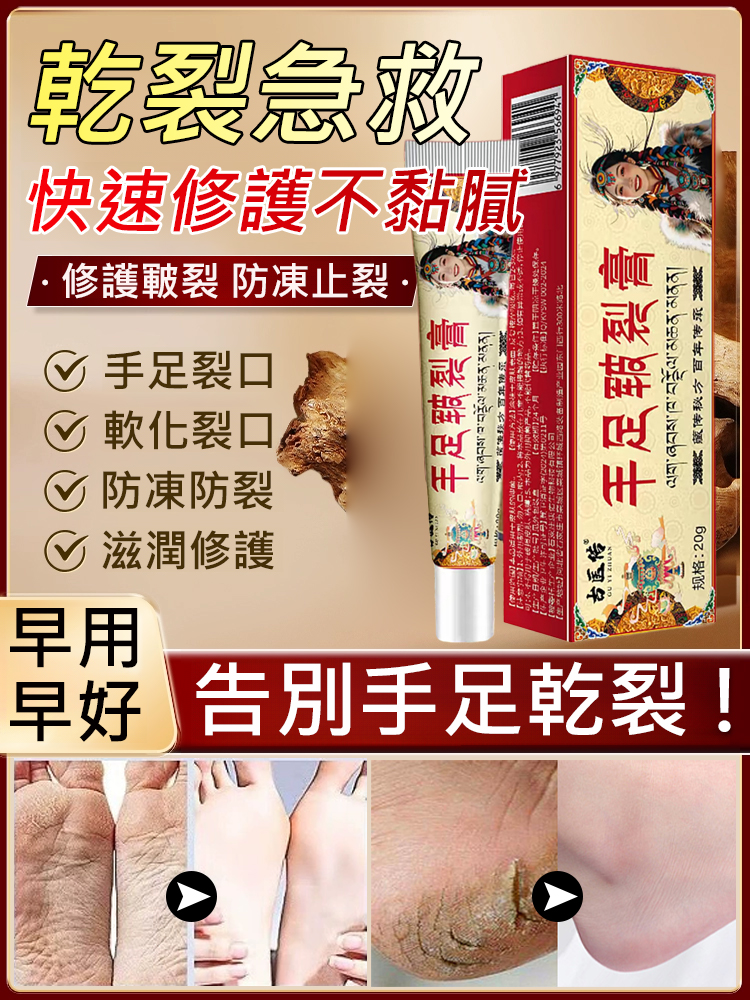 【專攻乾燥開裂】手足皸裂育