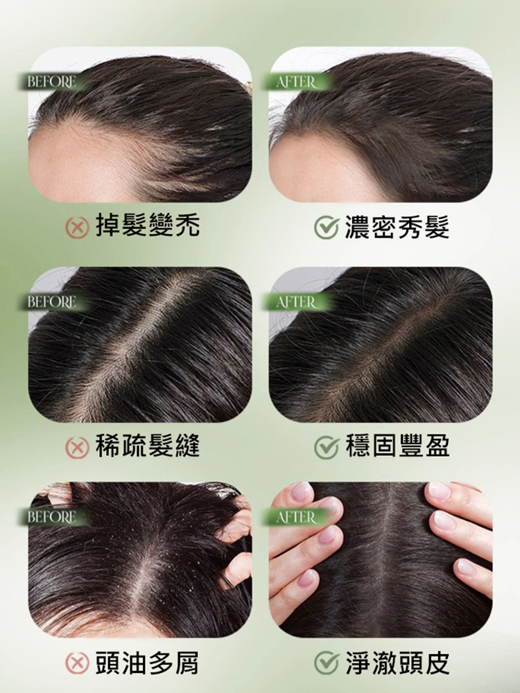【髪量漲20倍】烏斯曼草側柏葉洗髮皂