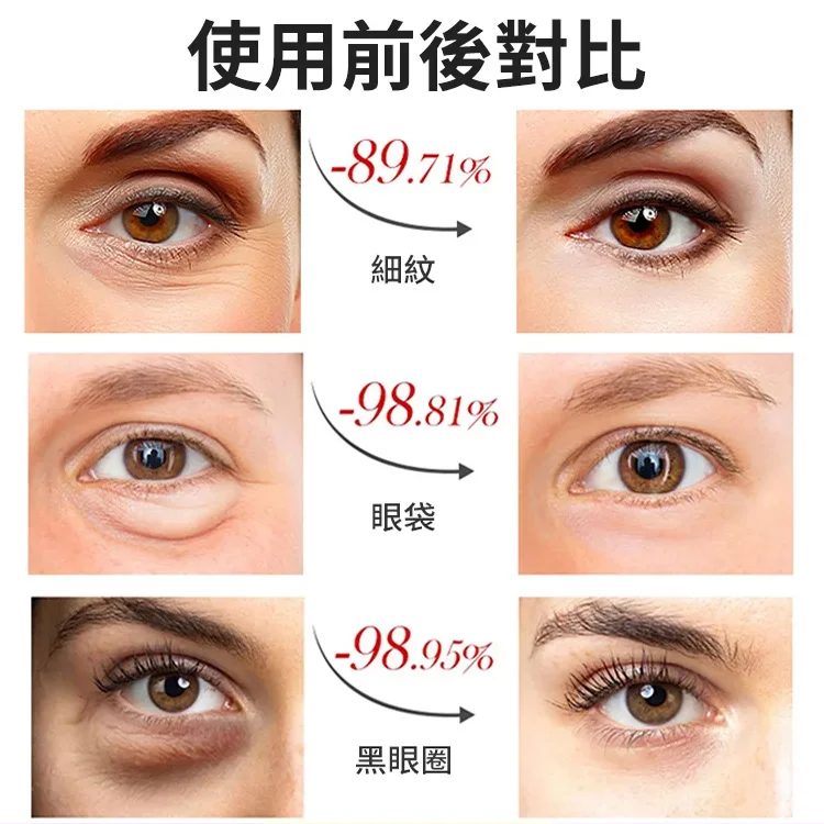 勻美醫師眼部按摩緊緻抗皺精華油