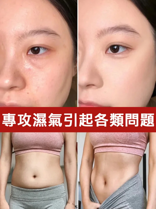 【冬病夏治】新款無菸艾灸罐