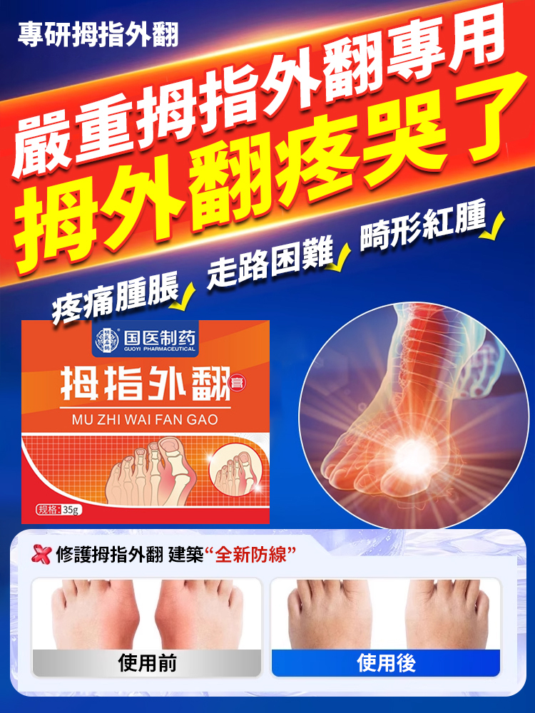 大拇指外翻專用膏