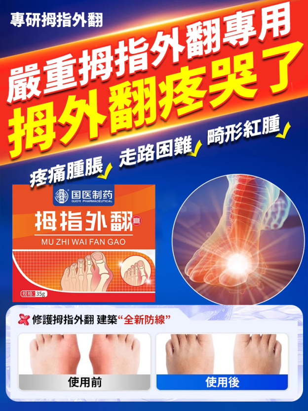 大拇指外翻專用膏